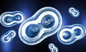 trisomy 21 extra chromosome