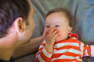 early diagnosis of down syndrome